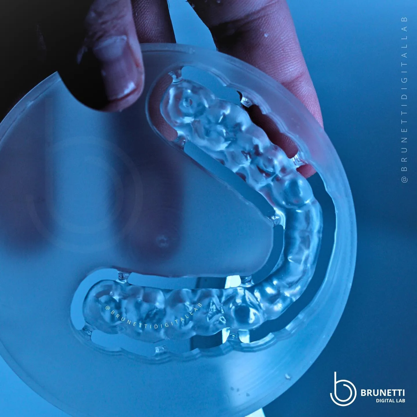 Modelo odontológico impresso em material transparente