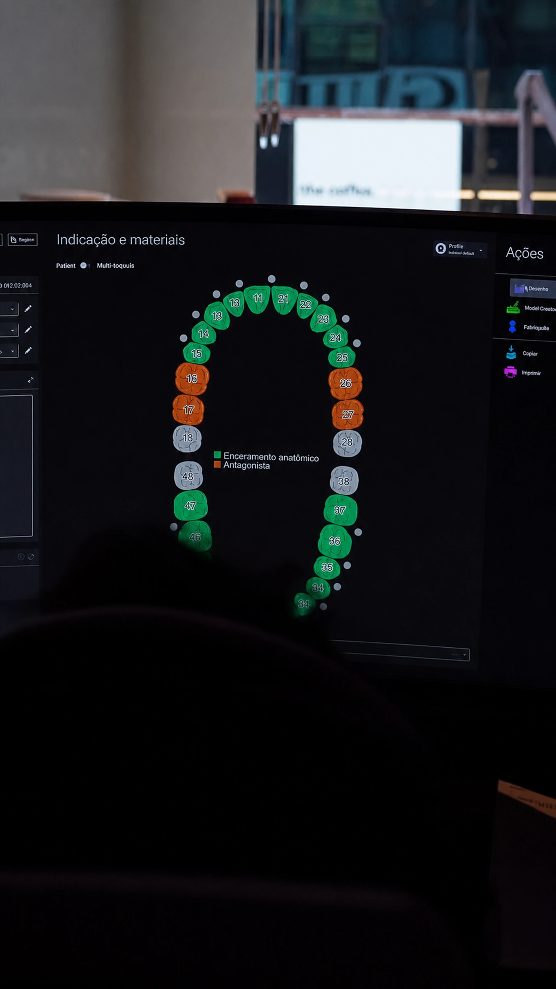 Monitor com planejamento digital de uma arcada odontológica